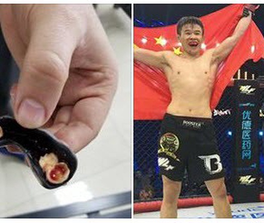Bản tin MMA 18/12: Võ sĩ Trung Quốc đấu MMA, "bay" mất hàm răng
