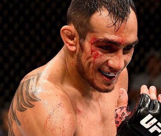 Tony Ferguson: Người ta nghĩ gì kệ họ!