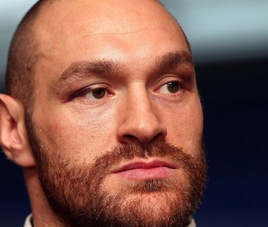 Tyson Fury đột ngột tuyên bố nghỉ hưu sau hàng loạt lùm xùm