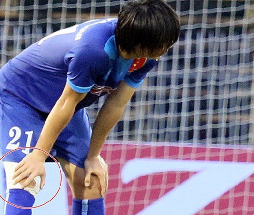 Tuấn Anh có thể lỡ hẹn lần thứ 2 liên tiếp với ĐT Việt Nam