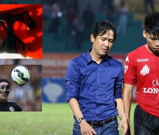 Trung vệ Long An bất lực tìm mua mặt nạ bảo vệ như Cesc Fabregas
