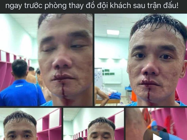 Sự thật cựu tuyển thủ QG Xuân Nam bị đánh đổ máu trong đường hầm