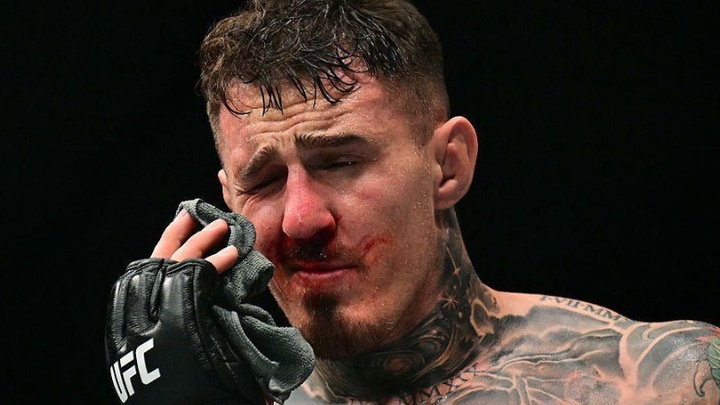 Tom Aspinall "thề trả thù Ciryl Gane", công bố giấy tờ xác nhận chấn thương mắt nghiêm trọng