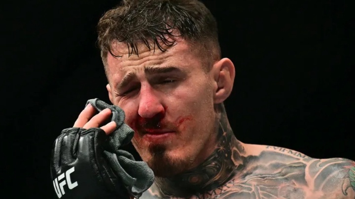 Tom Aspinall phải phẫu thuật hai mắt sau sự cố chọc mắt tại UFC 321