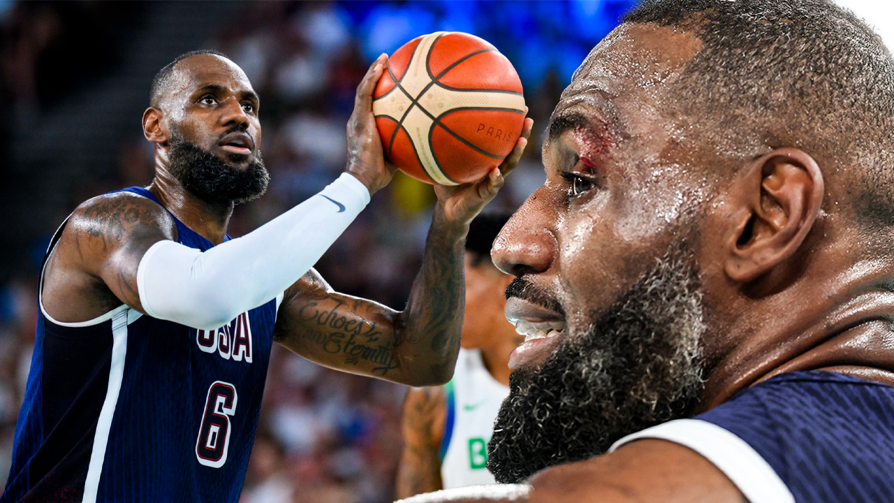 LeBron James rách mí mắt, khâu 4 mũi trước thềm 2 trận cuối cùng tuyển Mỹ tại Olympic 2024