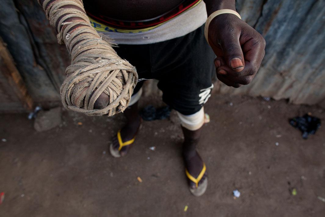 Dambe boxing: Môn võ bạo tàn của người Tây Phi