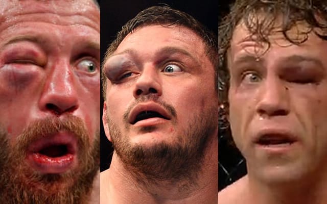 Chấn thương mắt trong thi đấu MMA dưới góc nhìn của bác sĩ