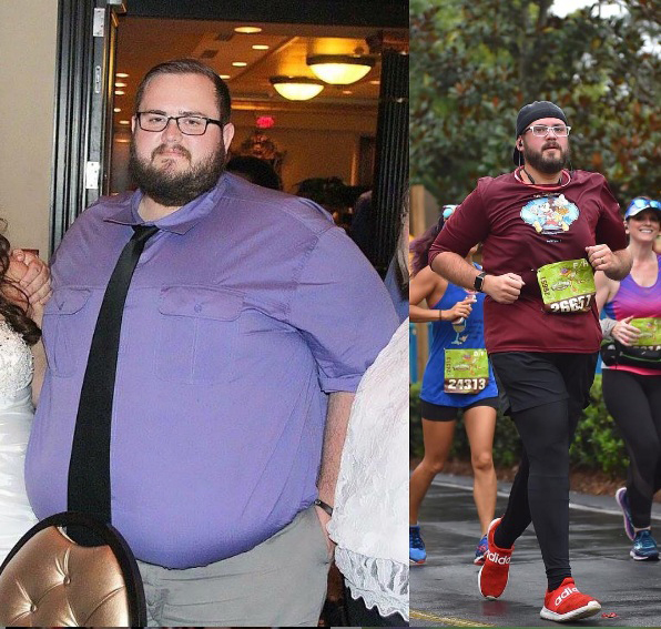 Chạy bộ khiến cuộc sống của bác sĩ hô hấp nặng 210kg tươi đẹp trở lại