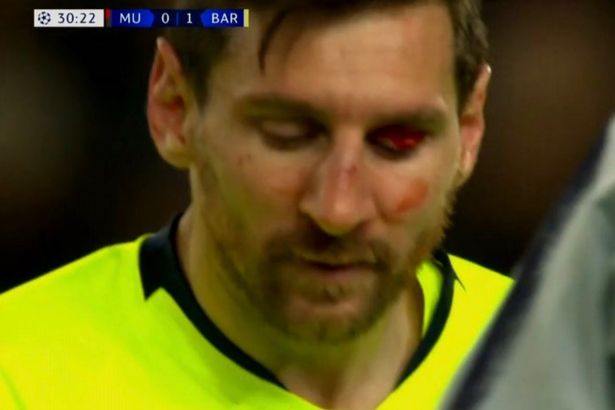 Chris Smalling ra đòn khiến Lionel Messi mặt đầy máu rời sân