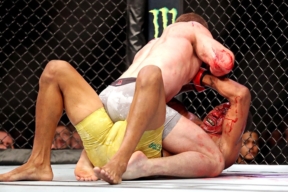 Alex Oliveira vs. Gunnar Nelson: Những bức ảnh chứng minh đòn chỏ là vũ khí đáng sợ nhất trên sàn MMA - Ảnh 4.