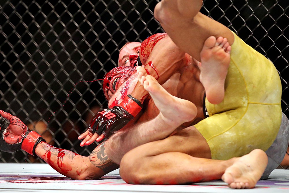 Alex Oliveira vs. Gunnar Nelson: Những bức ảnh chứng minh đòn chỏ là vũ khí đáng sợ nhất trên sàn MMA - Ảnh 6.