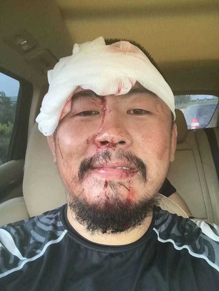 Hé lộ chân dung võ sĩ Muay Thái vừa đánh rách trán Từ Hiểu Đông - Ảnh 1.
