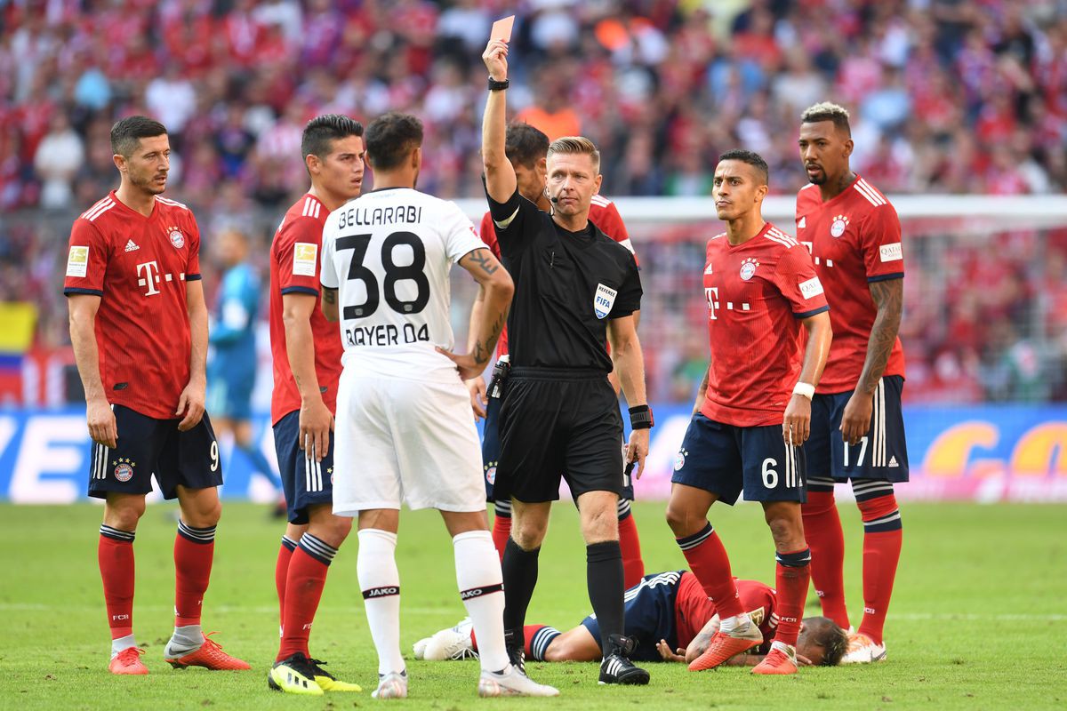 Bayern Munich mất 2 ngôi sao trong chiến thắng nhọc nhằn trước Leverkusen - Ảnh 2.