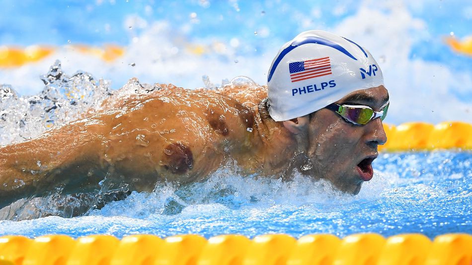 Những vết đỏ trên người Michael Phelps là ''dấu tích'' từ những lần giác hơi