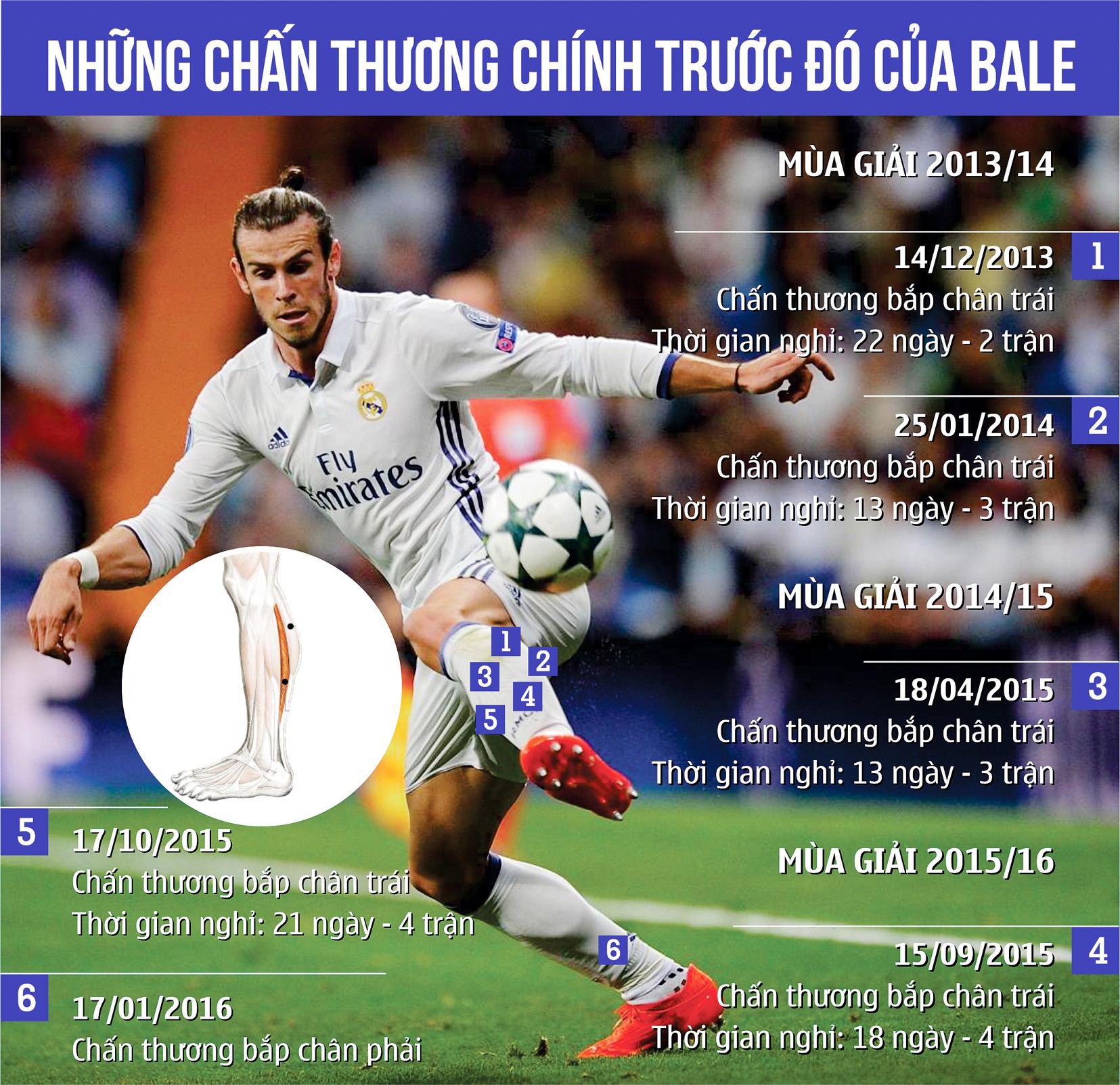 Vắng Bale, Real Madrid có thực sự nguy hại?