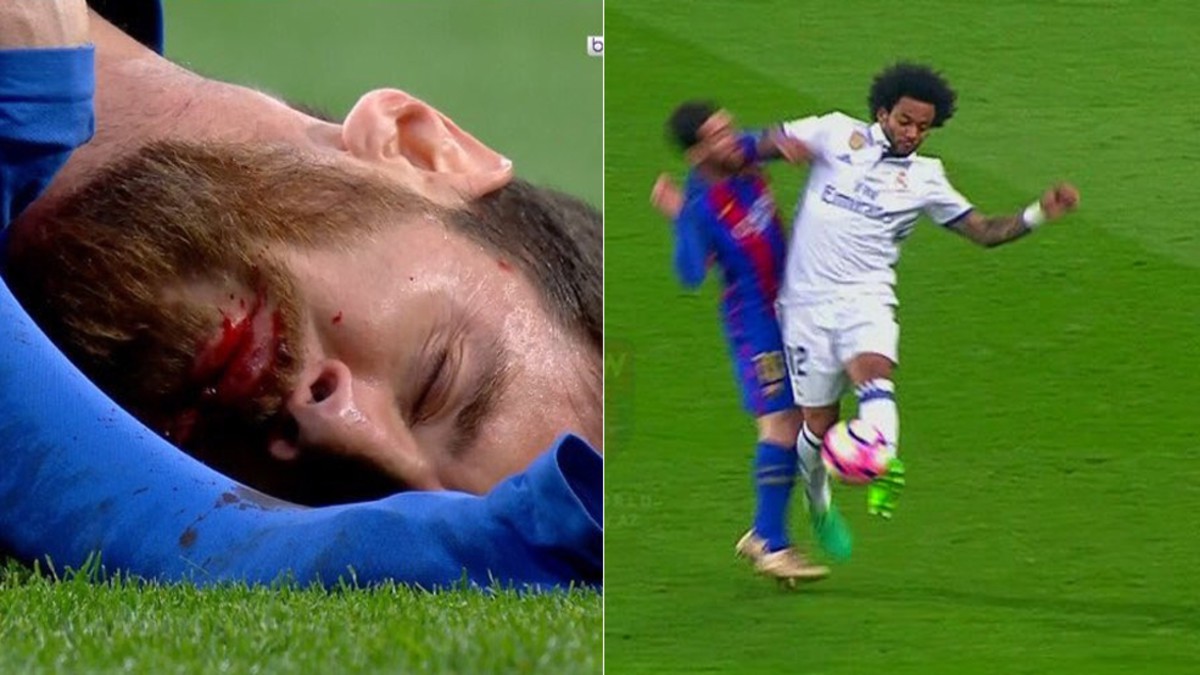  Hình ảnh: Messi từng bị Marcelo gác cùi chỏ trúng mặt khiến chảy máu mồm