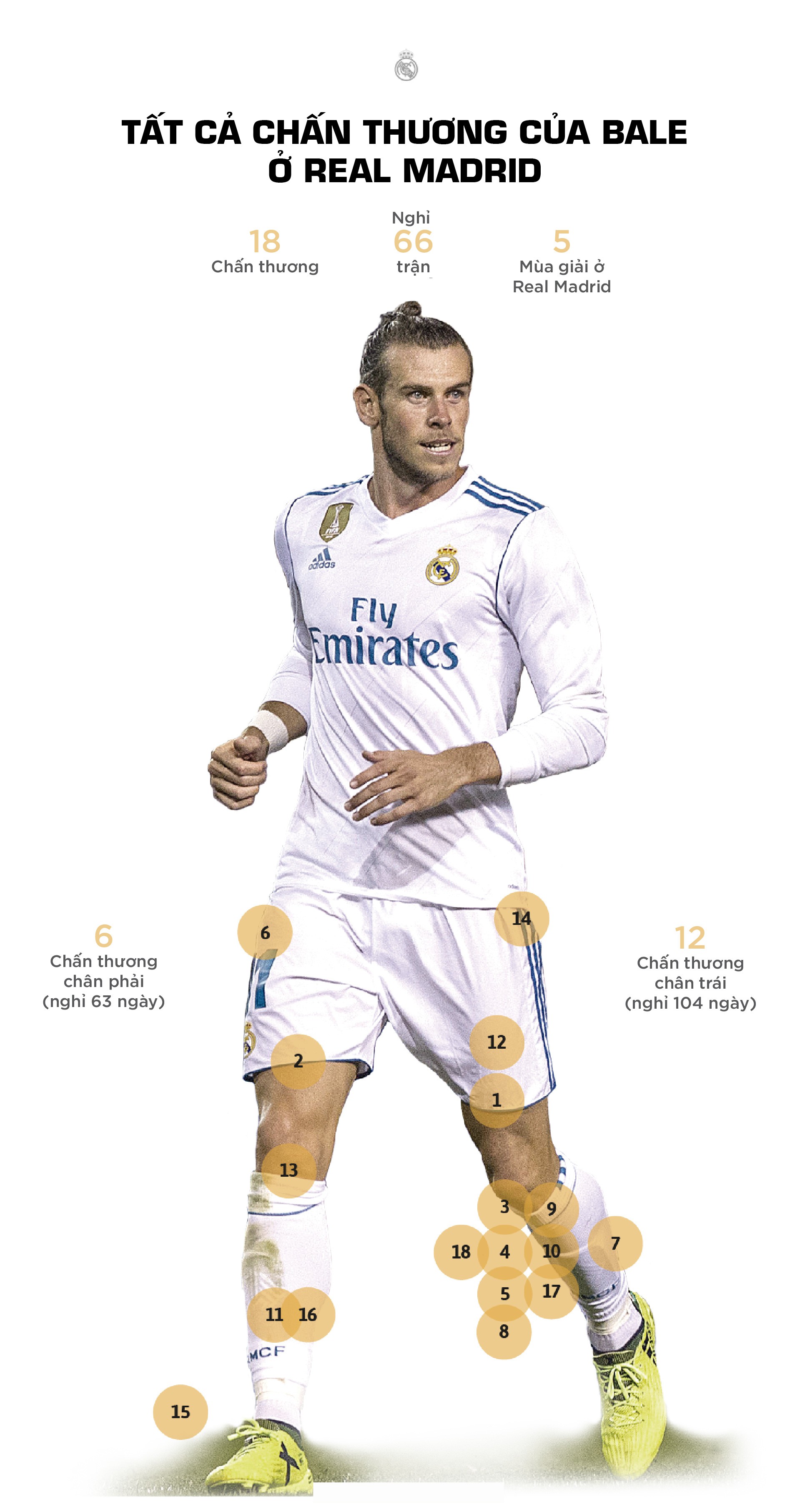 Toàn bộ chấn thương của Gareth Bale ở Real Madrid