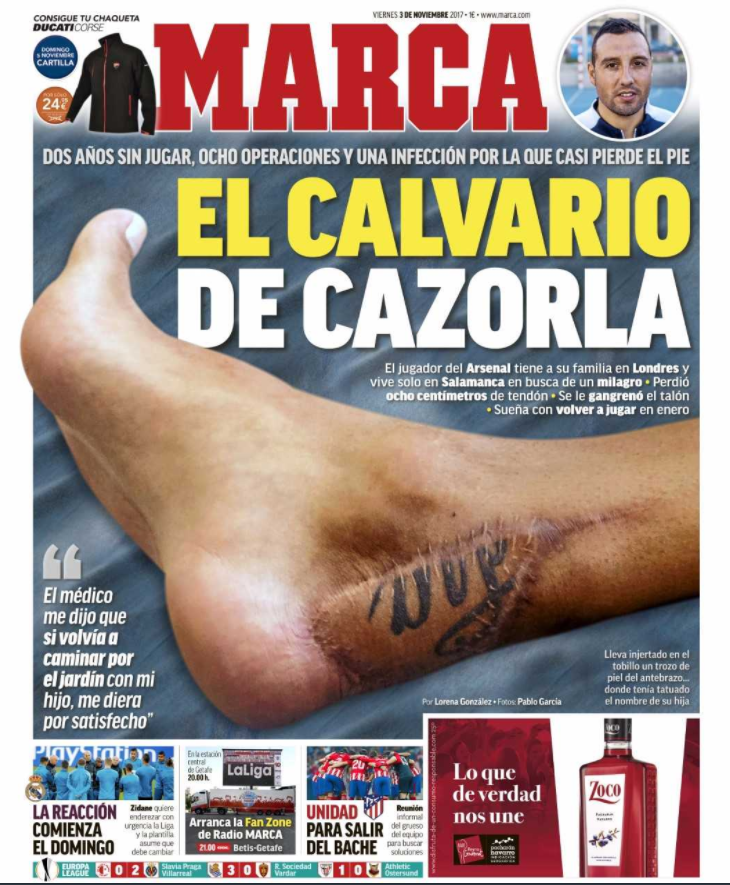 Tờ Marca đưa hình ảnh về chấn thương gót chân của Cazorla