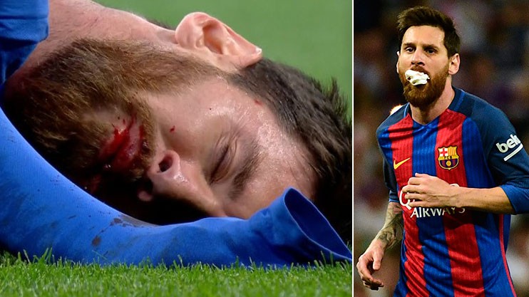 Trọng tài ở đâu, khi Messi bị đánh chảy máu mồm ở Siêu kinh điển?