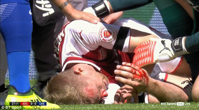 Khuôn mặt bê bết máu của đội trưởng Arsenal