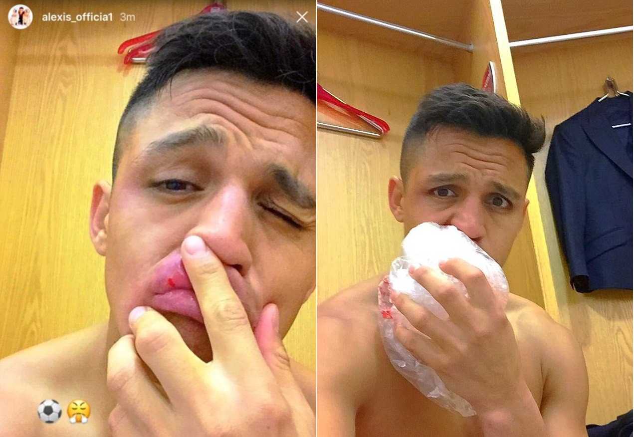 Alexis Sanchez bị “ném đá” tơi bời vì tái hiện... ''màn ăn vạ kinh điển''