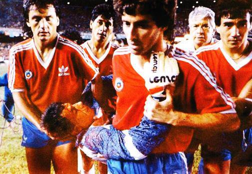Cầu thủ Chile khiêng thủ môn mặt bê bết máu của họ ra sân và đòi hủy trận đấu