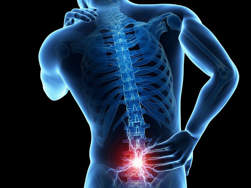 Đau lưng là một trong những căn bệnh phổ biến nhất, đồng thời là nguyên nhân chính dẫn tới bệnh bại liệt.